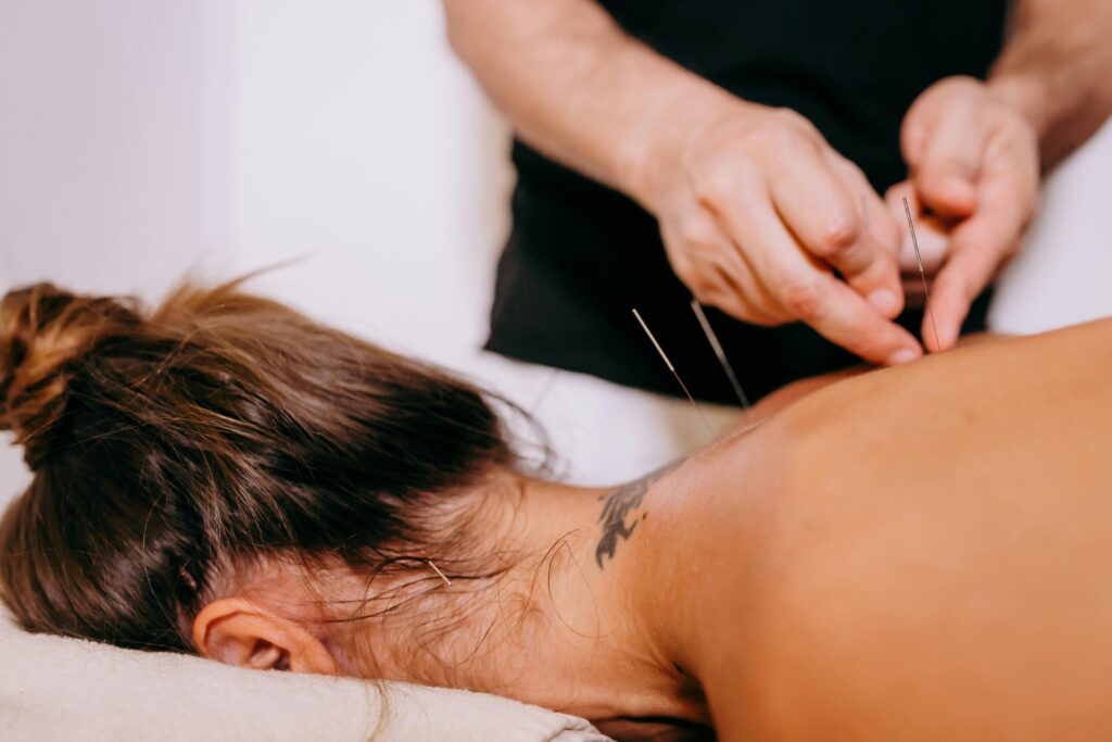 Acupncture sur une femme pour traiter insomnies, anxiété et induire une relaxation