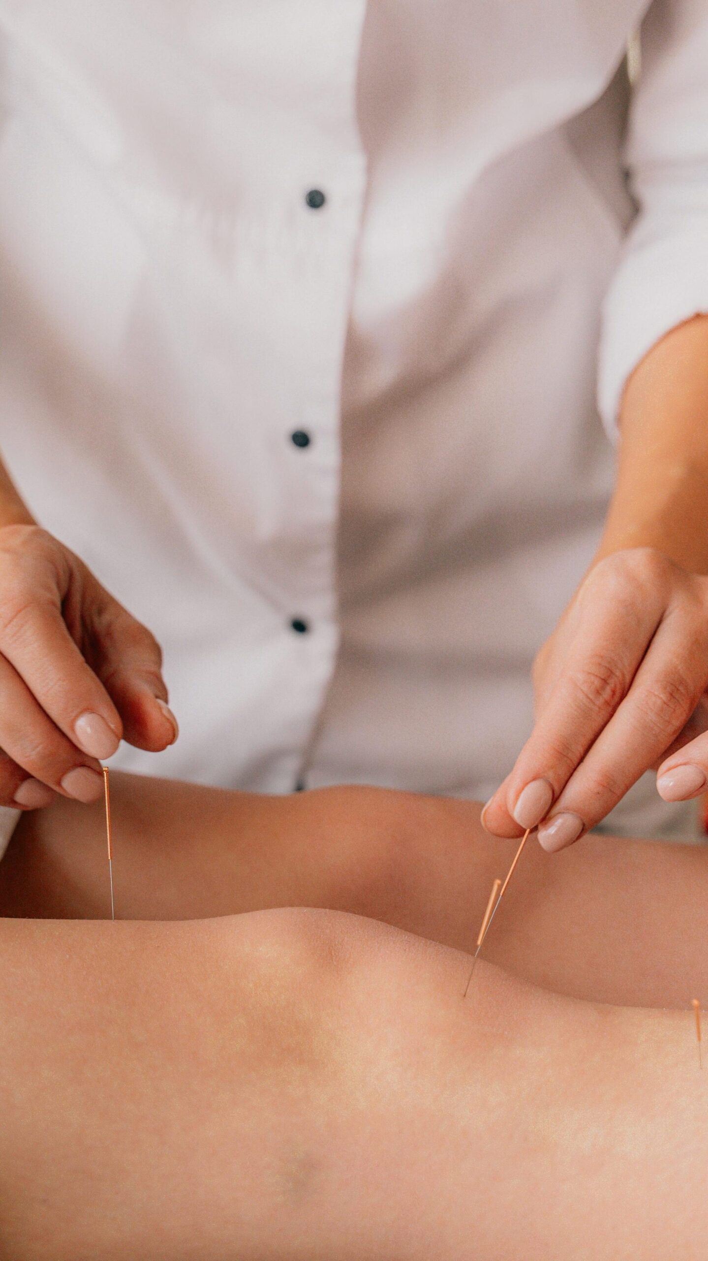 Médecine chinoise acupuncture traitement douleur