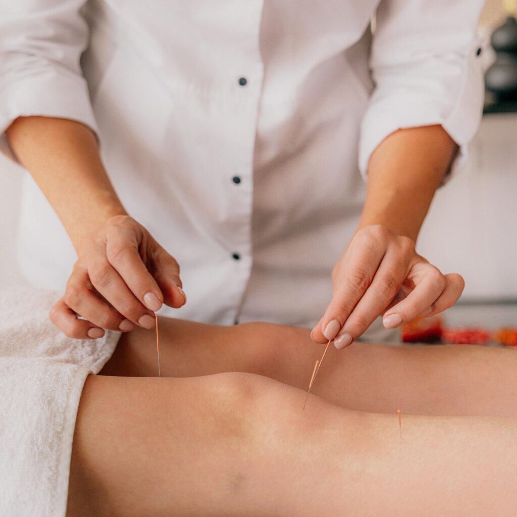 Médecine chinoise acupuncture traitement douleur