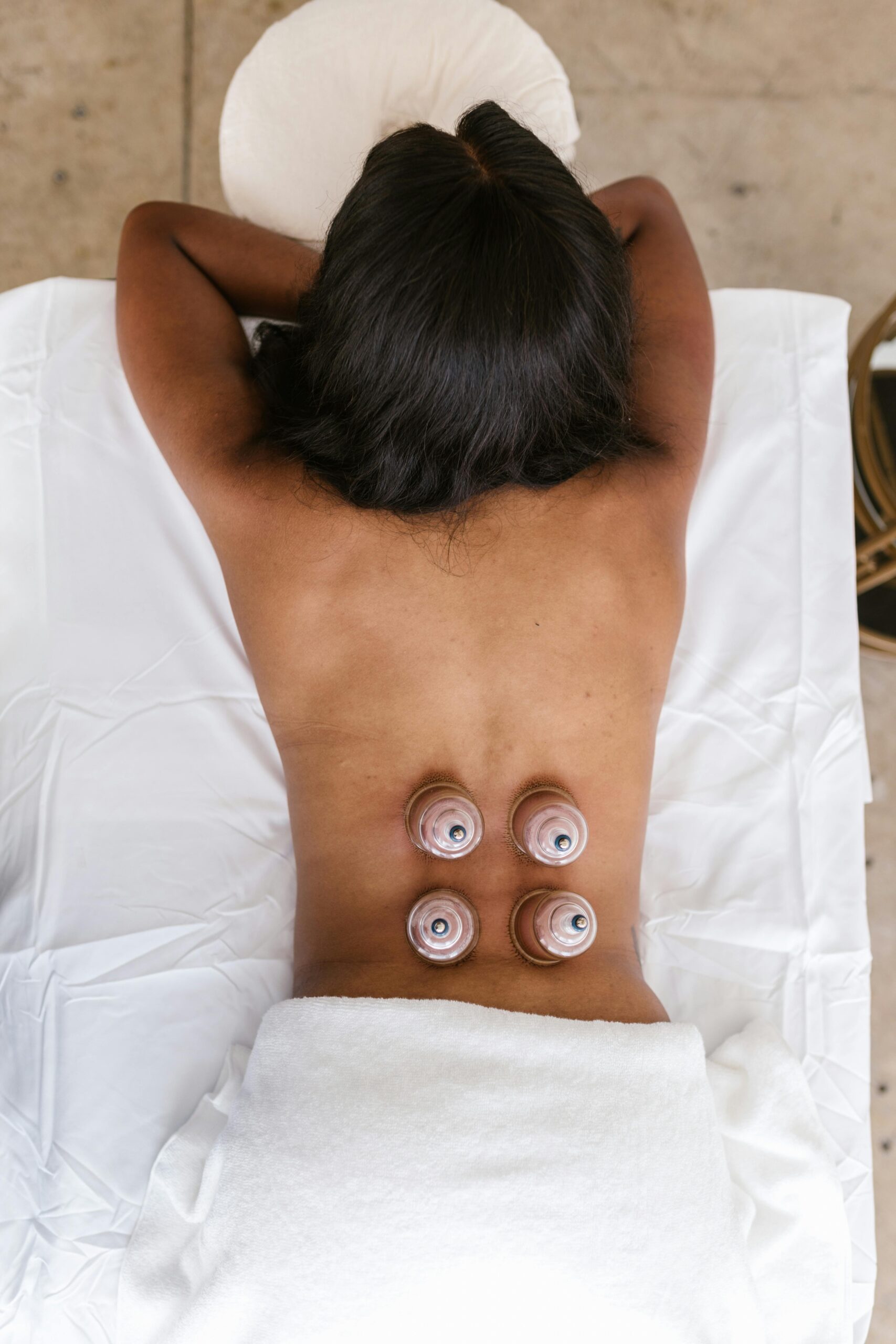 Ventouses thérapeutiques, cupping, hijama à Genève et Veyrier
