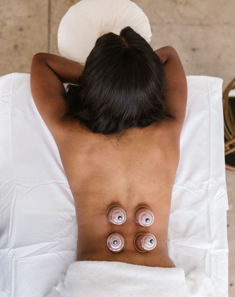 Back view of a woman receiving cupping therapy in a spa, promoting wellness and relaxation.